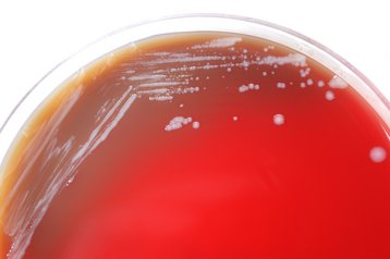 Burkholderia mallei oder Rotz genannt, in einer Petrischale. Es führt zu Lungenentzündung, Sepsis sowie Haut- und Schleimhautinfektionen. (Foto: CDC; gemeinfrei)