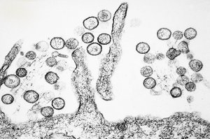 Das Sin-Nombre-Virus gehört zur Gattung der Hantaviren. (Bild: CDC/Cynthia Goldsmith; gemeinfrei)