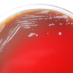 Burkholderia mallei oder Rotz genannt, in einer Petrischale. Es führt zu Lungenentzündung, Sepsis sowie Haut- und Schleimhautinfektionen. (Foto: CDC; gemeinfrei)